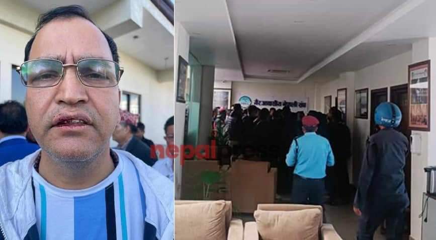 एनआरएनए कार्यालयमा एमालेको युवा संघको दादागिरी, पत्रकारमाथि कुटपिट र दूव्यर्वहार
